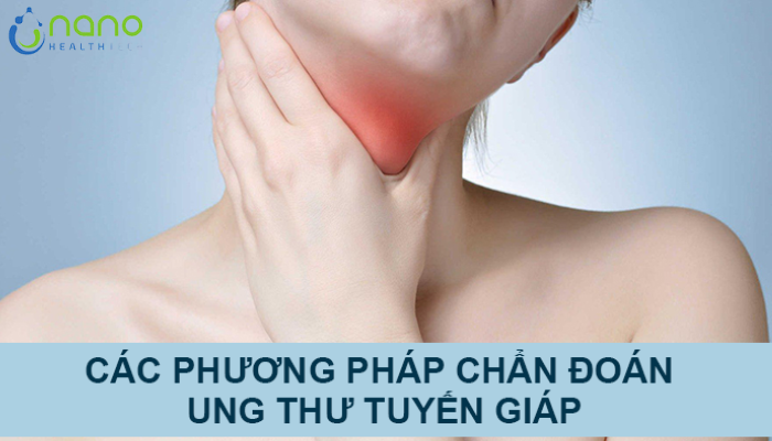 phuong-phap-chan-doan-ung-thu-tuyen-giap